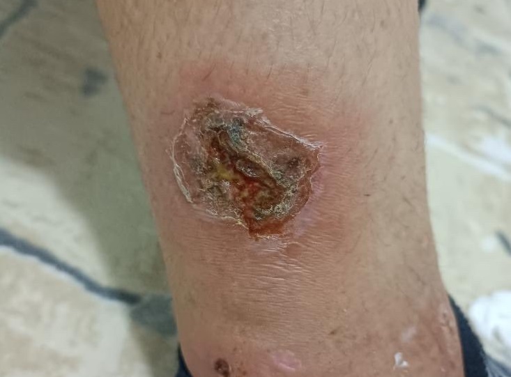 Cumhuriyet Halk Partisi Hatay Milletvekili Nermin Yıldırım Kara, İskenderun’daki angus